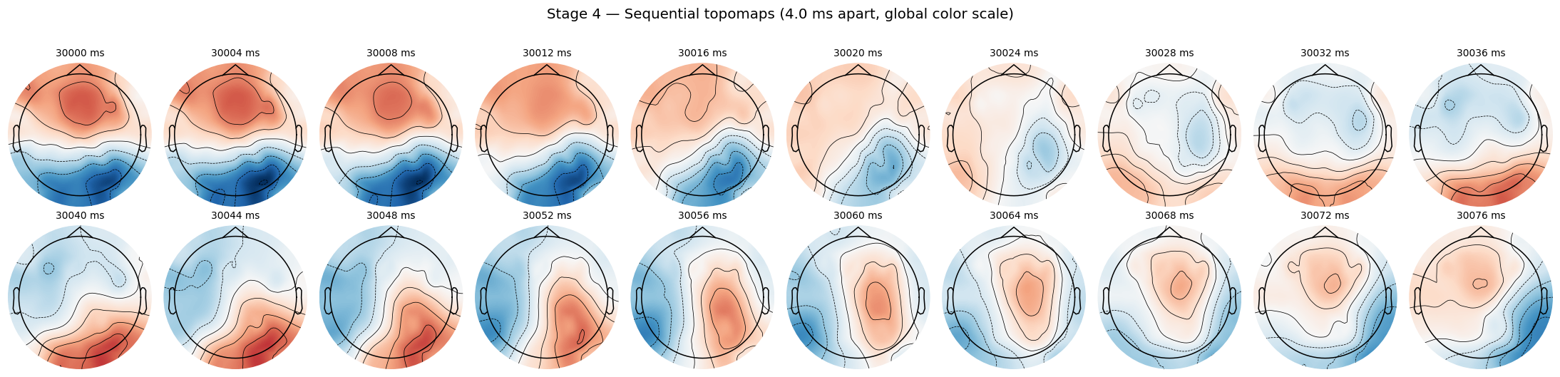 Stage 4: 20 sequential topomaps, 4 ms apart, global color scale